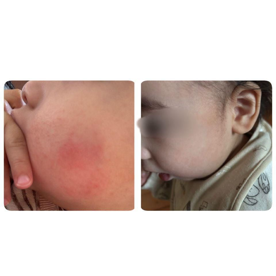 Mongdies Ato Lotion 300ml (Safe for both adults and babies)